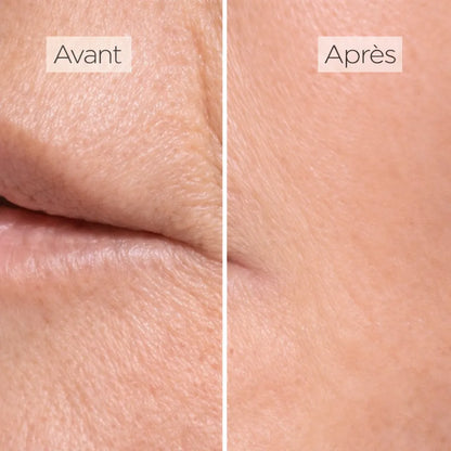 Masque Luminothérapie LED Visage – Soin Anti-Imperfections