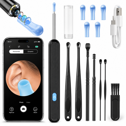 Otoscan | Nettoyeur d’Oreille Intelligent avec Caméra HD WiFi