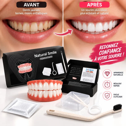 Facettes Dentaires Amovibles Smilé | Cache-dents cosmétique en silicone, haut et bas