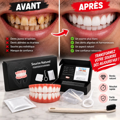 Facettes Dentaires Amovibles Smilé | Cache-dents cosmétique en silicone, haut et bas