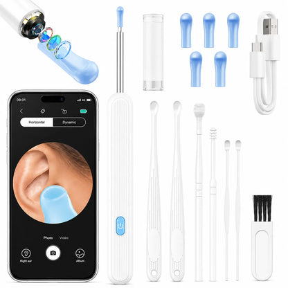 Otoscan | Nettoyeur d’Oreille Intelligent avec Caméra HD WiFi
